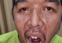 Sudah ditabrak Redho Malah Jadi Korban Penganiayaan