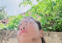 Tragis Seorang Wanita Inisial M Alami Penganiayaan
