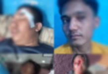 Disayangkan Konfercab HMI Bandarlampung Berujung Pengeroyokan